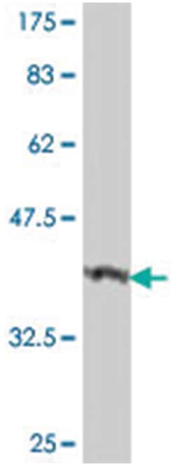 LOC91614, Mouse, Polyclonal Antibody, Abnova 50&mu;L; Unlabeled:Antibodies,