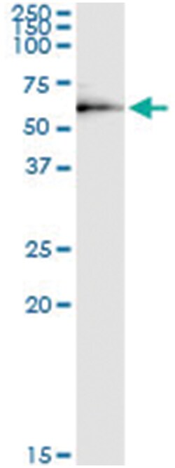 DEPDC7, Human, IP-WB Antibody Pair (PW1), Abnova&trade;