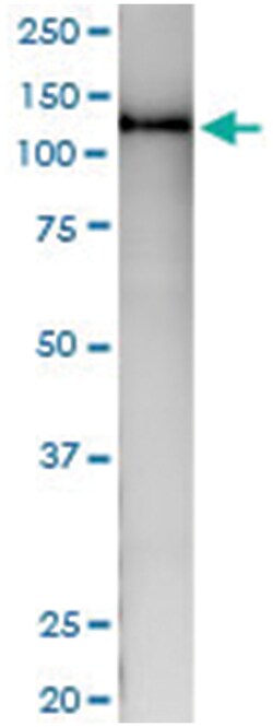 anti-NEK9, Human, IP-WB Antibody Pair, Abnova&trade;