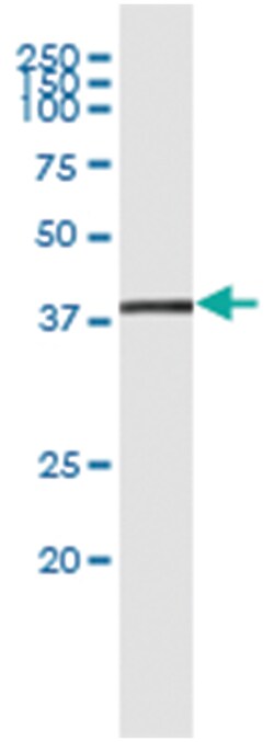 anti-STRADA, Human, IP-WB Antibody Pair, Abnova&trade;
