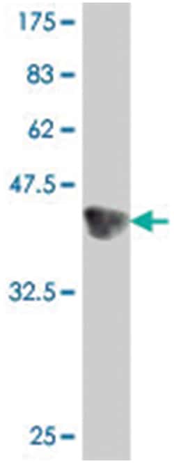DNER, Mouse, Polyclonal Antibody, Abnova 50&mu;L; Unlabeled:Antibodies,