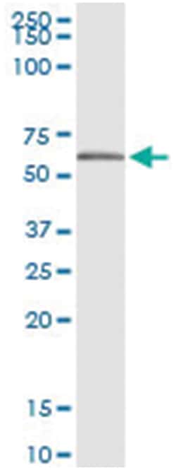 anti-NAPRT1, Human, IP-WB Antibody Pair, Abnova&trade;