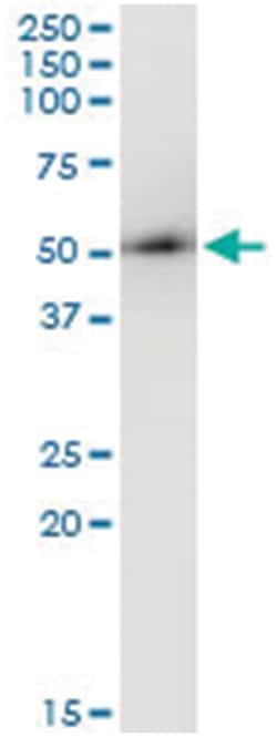 anti-ARMC6, Human, IP-WB Antibody Pair, Abnova™