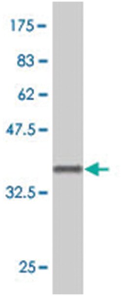 TADA2B, Mouse, Polyclonal Antibody, Abnova 50&mu;L; Unlabeled:Antibodies,