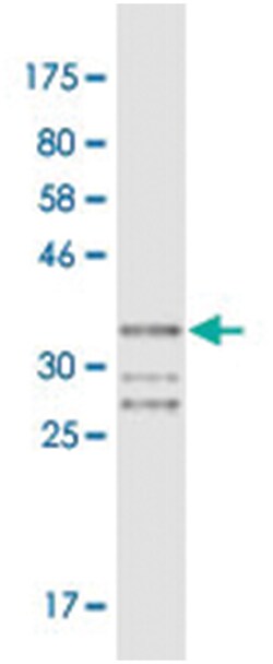 FOXQ1, Mouse, Clone: 3C1, Abnova 200&mu;L; Unlabeled:Antibodies, Monoclonal