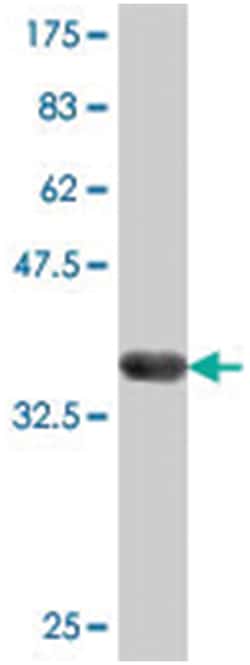 EPSTI1, Mouse, Polyclonal Antibody, Abnova 50&mu;L; Unlabeled:Antibodies,