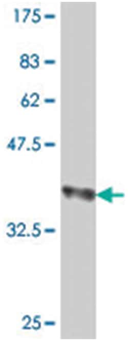 IL17F, Mouse, Polyclonal Antibody, Abnova 50μL; Unlabeled:Antibodies,