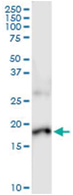 anti-IL17F, Human, IP-WB Antibody Pair, Abnova&trade;