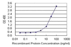 TP53RK, Human, Matched Antibody Pair (AP42), Abnova™