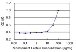 Abnova TP53RK, Human, Matched Antibody Pair (AP44), Abnova™