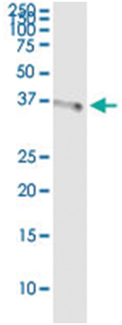 SDSL, Human, IP-WB Antibody Pair (PW4), Abnova 1 Set:Antibodies, Monoclonal/Polyclonal
