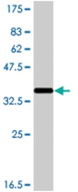 NLRP3, Mouse, Polyclonal Antibody, Abnova 50&mu;L; Unlabeled:Antibodies,