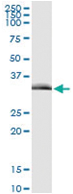 anti-TIRAP, Human, IP-WB Antibody Pair, Abnova 1 Set:Antibodies, Monoclonal/Polyclonal