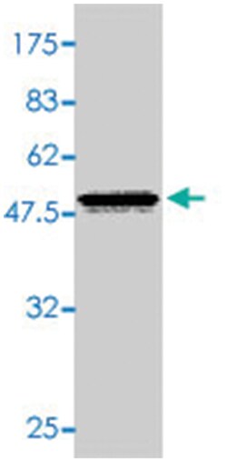 CYGB, Mouse, Polyclonal Antibody, Abnova 50 &mu;L | Buy Online | Abnova Corporation | Fisher Scientific