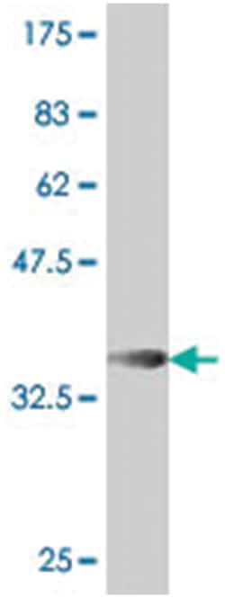 BTBD9 (A01), Mouse anti-Human, Polyclonal Antibody, Abnova 50 &mu;L | Buy Online | Abnova | Fisher Scientific