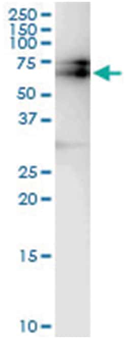 anti-BTBD9, Human, IP-WB Antibody Pair, Abnova&trade;