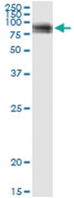 anti-VASN, Human, IP-WB Antibody Pair, Abnova 1 Set:Antibodies, Monoclonal/Polyclonal