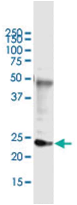 anti-DDIT4L, Human, IP-WB Antibody Pair, Abnova&trade;