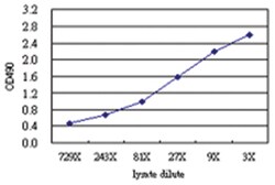 anti-RASGRP4 Matched Antibody Pair, Abnova&trade;