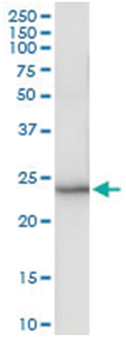 anti-ARL11, Human, IP-WB Antibody Pair, Abnova 1 Set:Antibodies, Monoclonal/Polyclonal