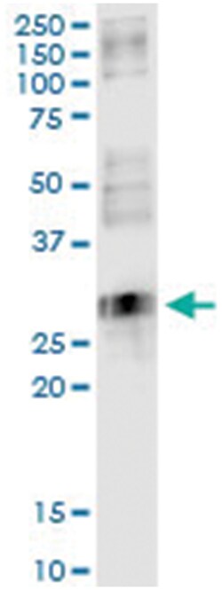 NXNL1, Human, IP-WB Antibody Pair (PW1), Abnova 1 Set:Antibodies, Monoclonal/Polyclonal