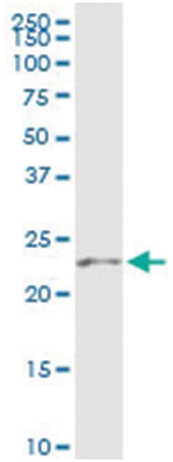anti-RAB39B, Human, IP-WB Antibody Pair, Abnova 1 Set:Antibodies