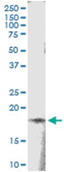 anti-TSEN15, Human, IP-WB Antibody Pair, Abnova&trade;
