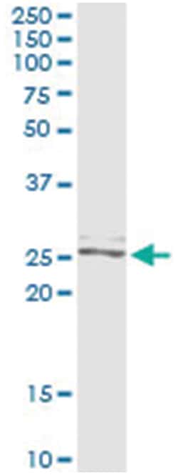 TWIST2, Human, IP-WB Antibody Pair (PW1), Abnova 1 Set:Antibodies, Monoclonal/Polyclonal