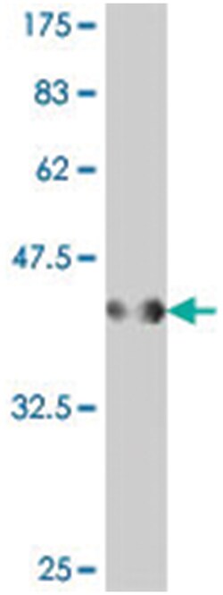 PDZK8, Mouse, Polyclonal Antibody, Abnova 50&mu;L; Unlabeled:Antibodies,