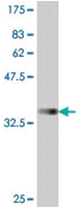 LRRK2, Mouse, Polyclonal Antibody, Abnova 50&mu;L; Unlabeled:Antibodies,