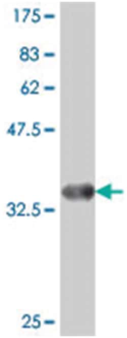 JDP2, Mouse, Polyclonal Antibody, Abnova 50 &mu;L | Buy Online | Abnova | Fisher Scientific