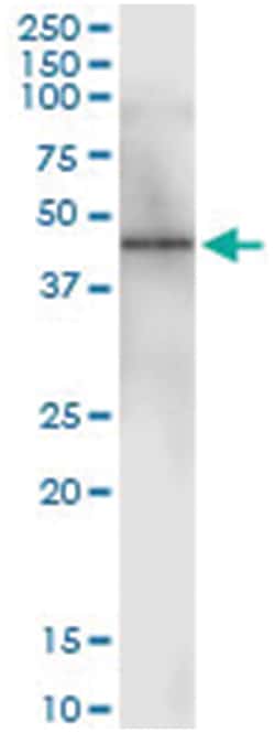 CANT1, Human, IP-WB Antibody Pair (PW1), Abnova™