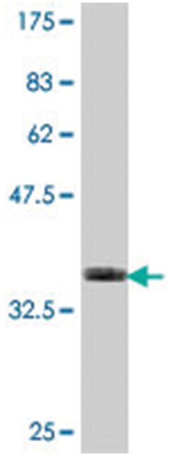 COX6B2, Mouse, Polyclonal Antibody, Abnova™