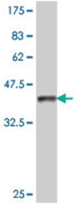 IQGAP3, Mouse, Polyclonal Antibody, Abnova 50&mu;L; Unlabeled:Antibodies,