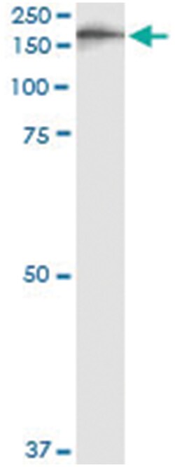 IQGAP3, Human, IP-WB Antibody Pair (PW1), Abnova 1 Set:Antibodies, Monoclonal/Polyclonal