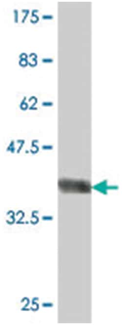 DGKK, Mouse, Polyclonal Antibody, Abnova 50 &mu;L | Buy Online | Abnova | Fisher Scientific