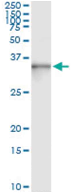 anti-ASB9, Human, IP-WB Antibody Pair, Abnova&trade;
