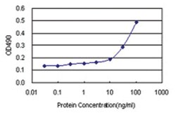 anti-MYL6B Matched Antibody Pair, Abnova 1 Set; Unlabeled:Antibodies, Monoclonal/Polyclonal