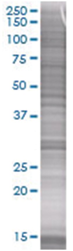 RNF32 293T Cell Overexpression Lysate 1 (Denatured), Abnova 100 &mu;L | Buy Online | Abnova | Fisher Scientific