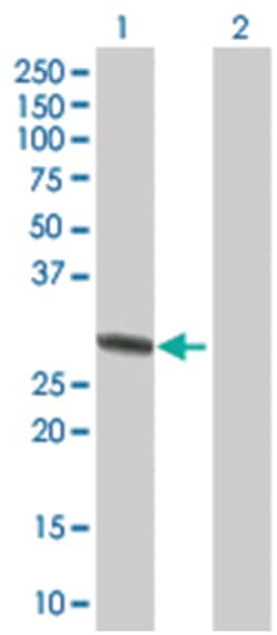 RNF32 293T Cell Overexpression Lysate 1 (Denatured), Abnova 100 &mu;L | Buy Online | Abnova | Fisher Scientific
