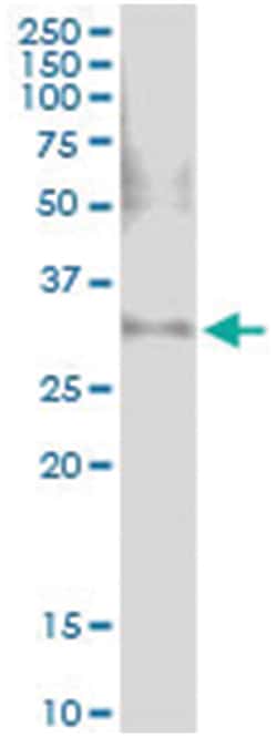 anti-C10ORF46, Human, IP-WB Antibody Pair, Abnova 1 Set:Anticuerpos