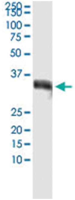 GSC, Human, IP-WB Antibody Pair (PW4), Abnova™