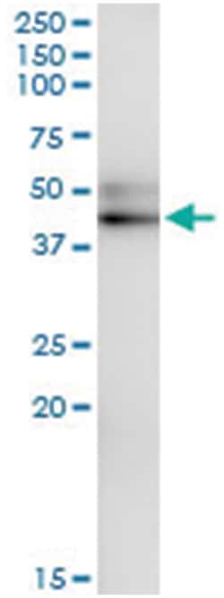 SERPINA12, Human, IP-WB Antibody Pair (PW1), Abnova&trade;