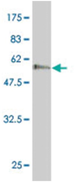 HAPLN3, Mouse, Polyclonal Antibody, Abnova 50&mu;L; Unlabeled:Antibodies,
