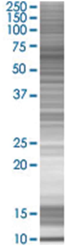 WDR16 293T Cell Overexpression Lysate (Denatured), Abnova 100 &mu;l | Buy Online | Abnova | Fisher Scientific