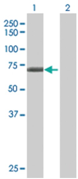 WDR16 293T Cell Overexpression Lysate (Denatured), Abnova 100 &mu;l | Buy Online | Abnova | Fisher Scientific
