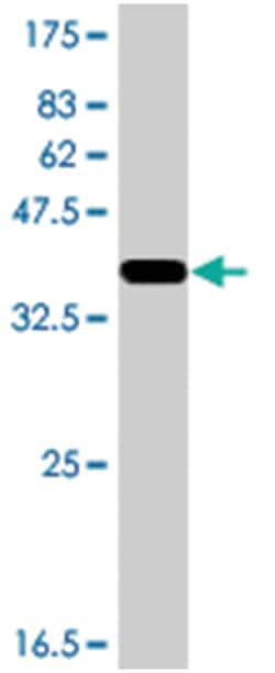 PIK3R6 (C17orf38), Mouse, Polyclonal Antibody, Abnova 50&mu;L; Unlabeled:Antibodies,
