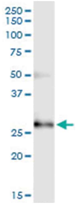 anti-CCBE1, Human, IP-WB Antibody Pair, Abnova 1 Set:Antibodies, Monoclonal/Polyclonal
