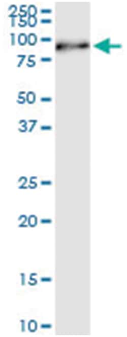 anti-HIPK4, Human, IP-WB Antibody Pair, Abnova 1 Set:Antibodies, Monoclonal/Polyclonal