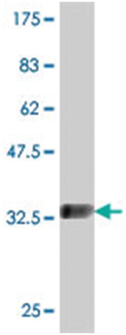 MOBKL2C, Mouse, Polyclonal Antibody, Abnova 50&mu;L; Unlabeled:Antibodies,